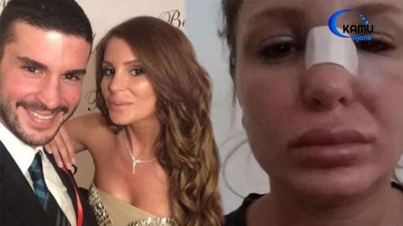 Berk Oktay'dan Eşi Merve Şarapçıoğlu'na Dayak