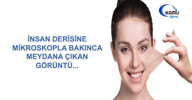 İnsan Derisine Mikroskopla Bakınca, Meydana Çıkan Görüntü...