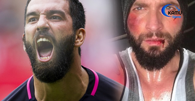 Arda Turan Berkay Kavgasında Skandal İddaa