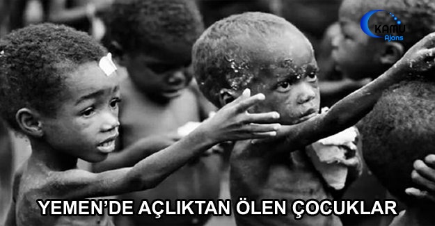 Yemen’de Açlıktan Ölen Çocuklar