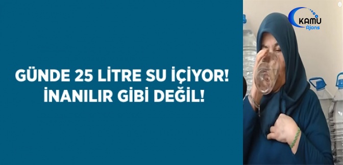 Günde 25 Litre Su İçiyor! Akıl Almaz Olay Hayret Ettirdi
