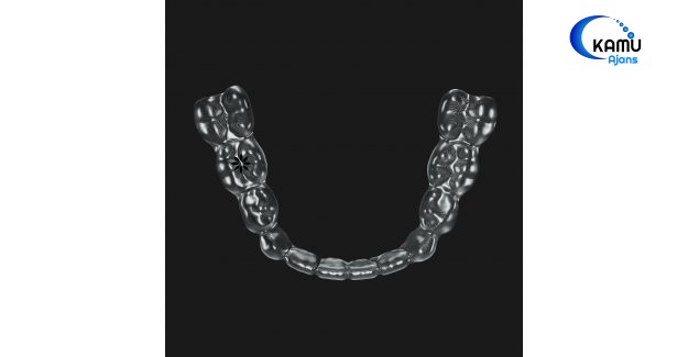 Mandibular Advancement Özellikli Invisalign Comprehensive Tedavisi
