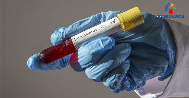 Koronavirüs (COVID-19) Veriler (27 Nisan 2020)
