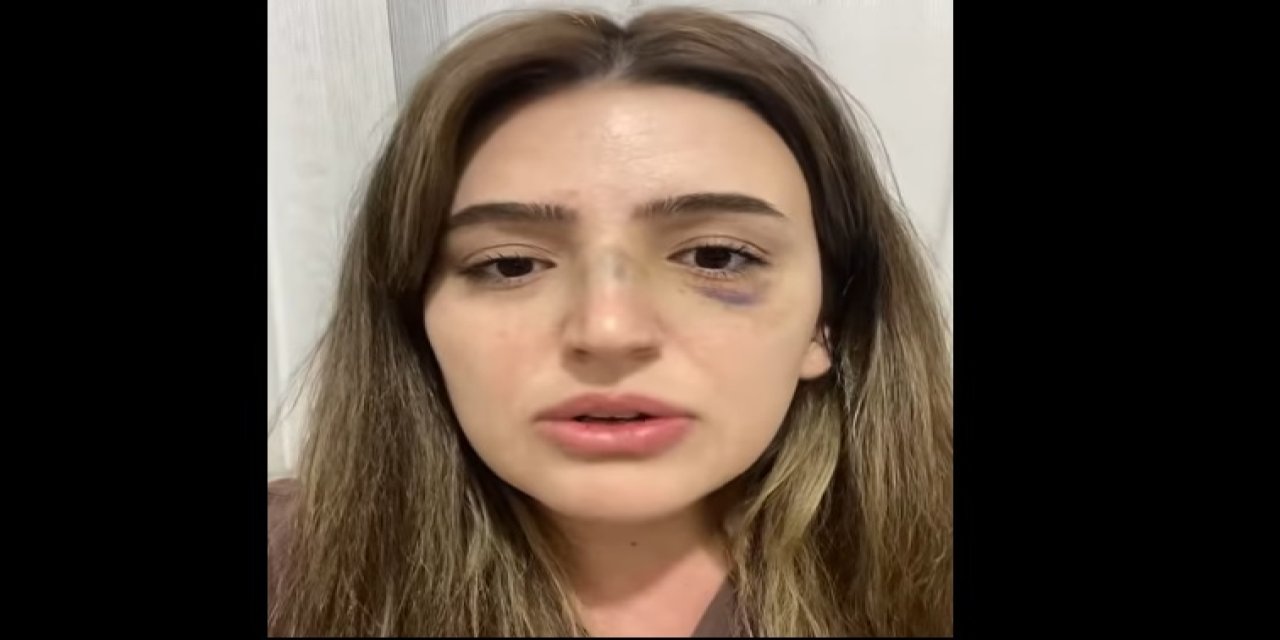Teğmen Eşi Tarafından Darp Edilen Öğretmenin Burnu Kırıldı