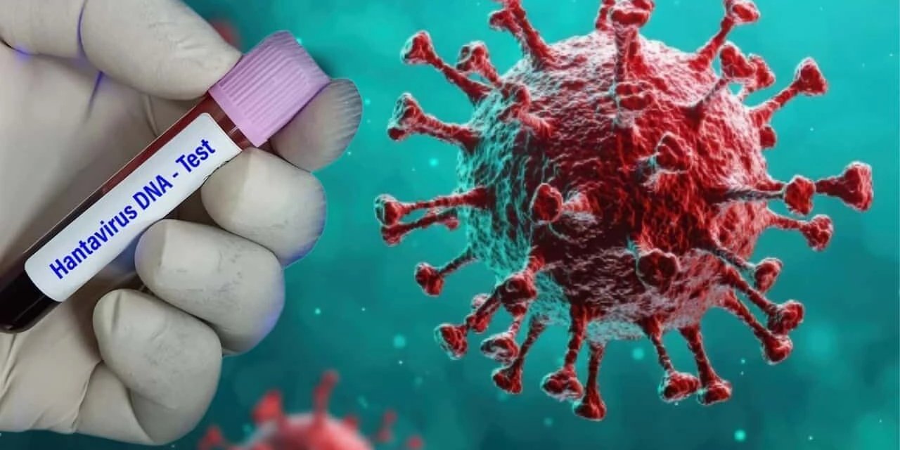 Sağlık Bakanlığı Hantavirüs Test Sonuçlarını Açıkladı: Pozitif Vaka Var mı?