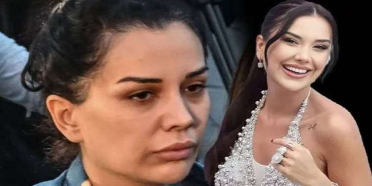 Dilan Polat'ın Son Hali : Bir Deri Bir Kemik Kalmış!